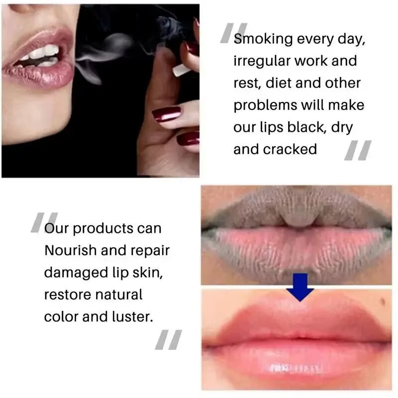 Moisturizing Lip Balm Lip Scrub Vaseline Remove Dark Lighten Melanin Lip Mask Fade Lip Line Dead Skin Repair Lip Care Products